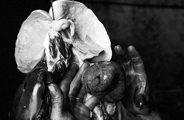 hands heart and lungs - Gustav Eckart, Photography